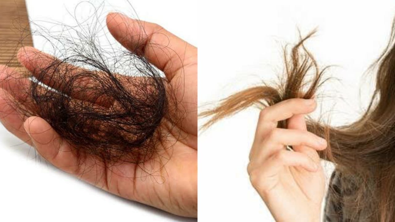 hair falling may be prevented by changing your food habits