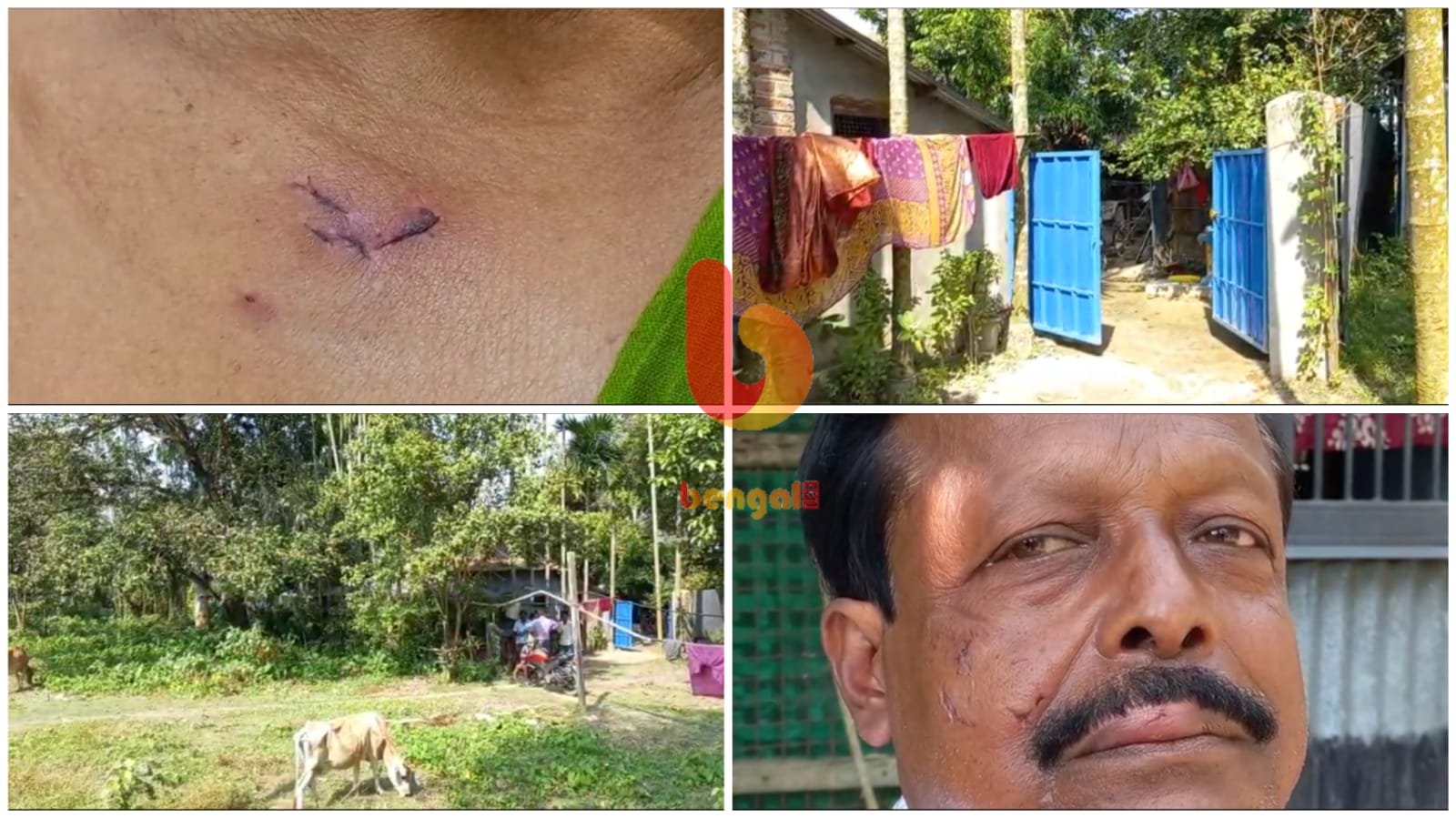 Two injured in fox attack in Raiganj during the day